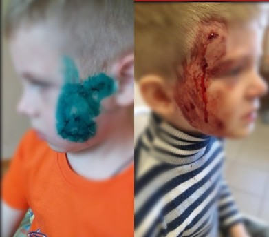 Собаку, напавшую на ребёнка, поймали в Никеле