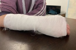 Человек с забинтованной рукой