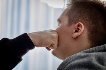 Удар кулаком по лицу