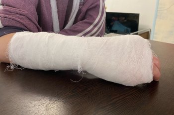 Человек с забинтованной рукой