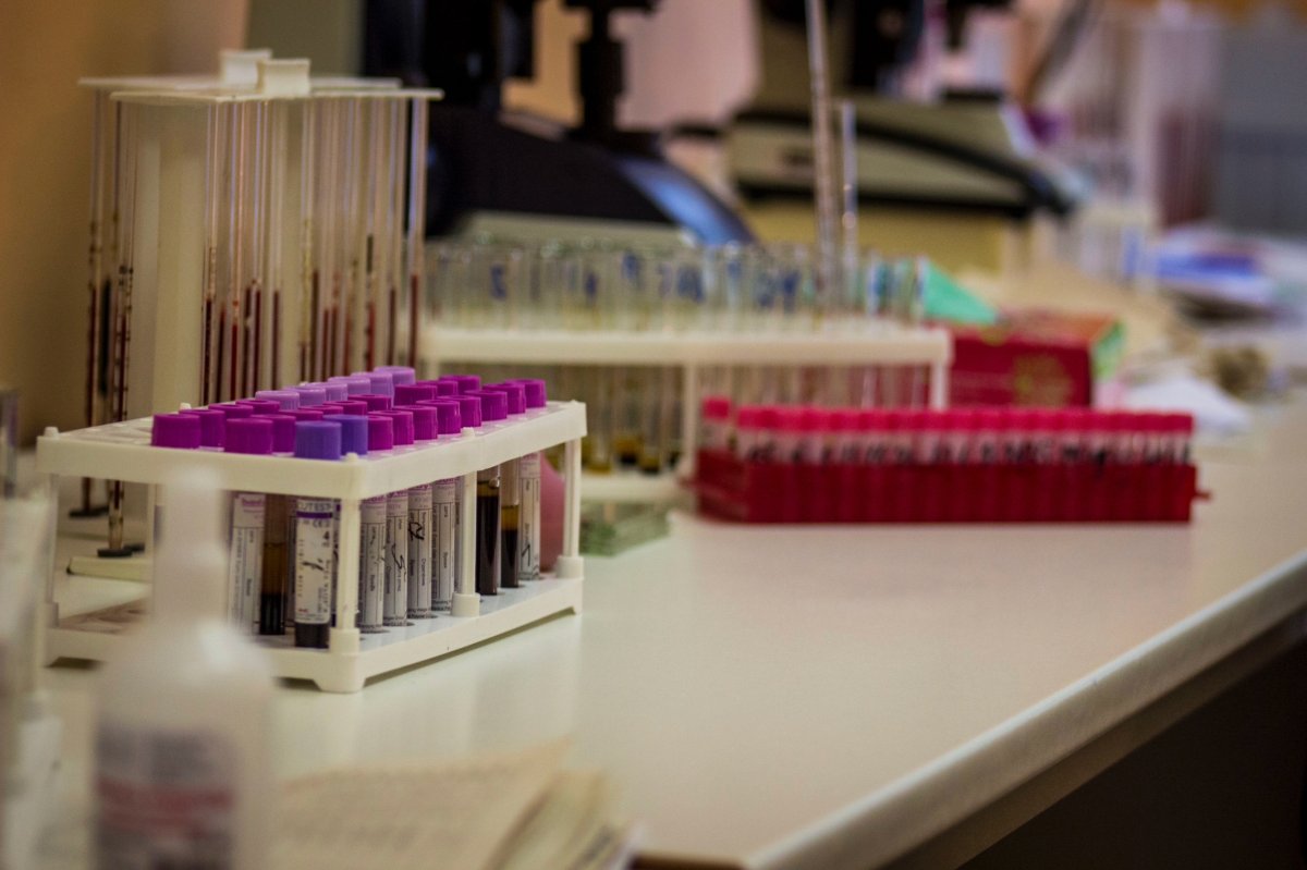Пробирки с анализами.
